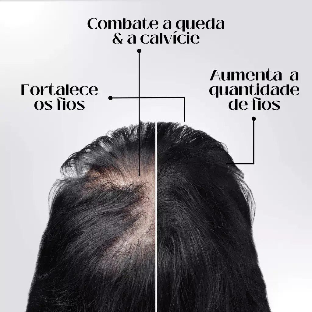 Tônico Capilar Repair Hair® | Crescimento Capilar e Combate à Queda de Cabelo - Bela Vital