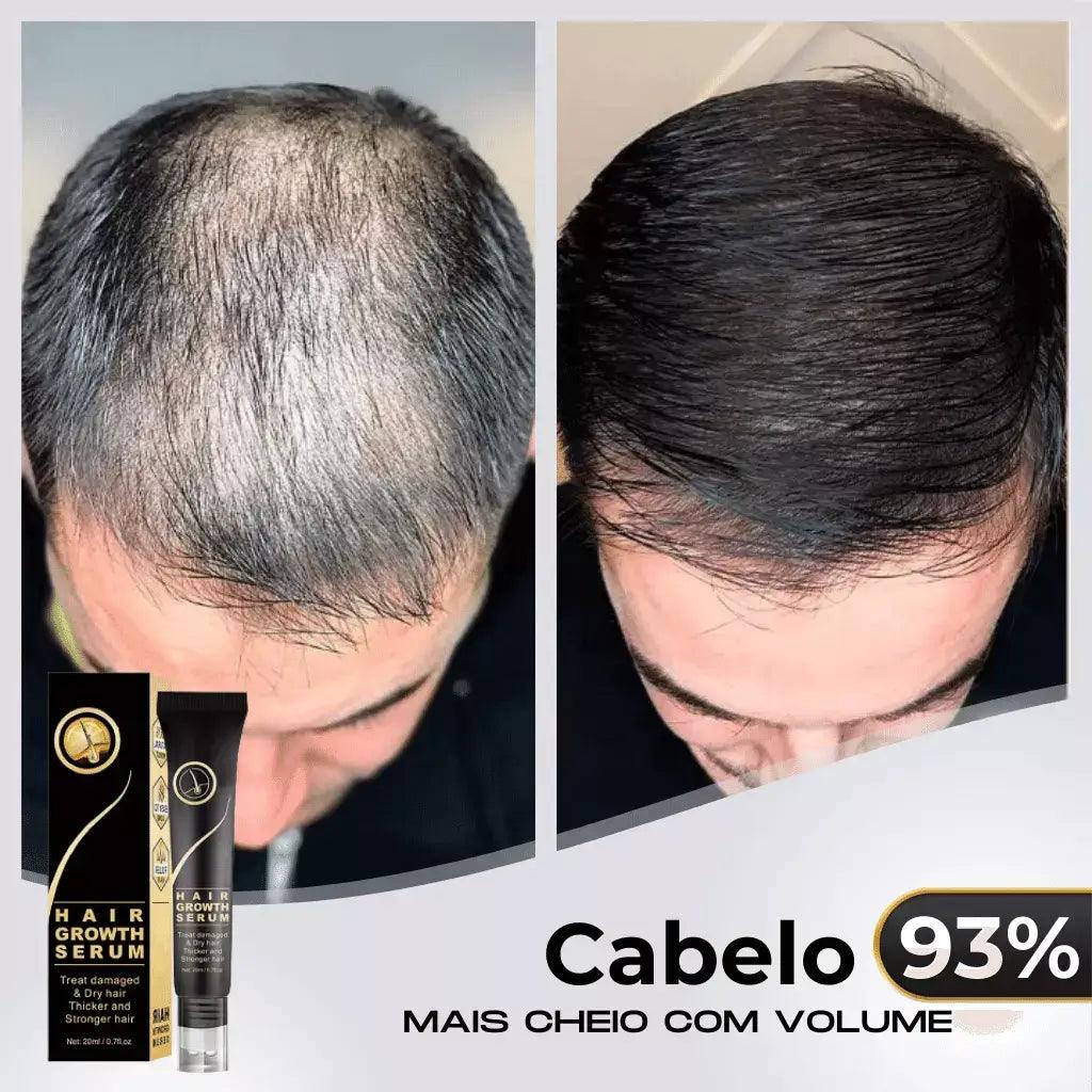 Tônico Capilar Repair Hair® | Crescimento Capilar e Combate à Queda de Cabelo - Bela Vital