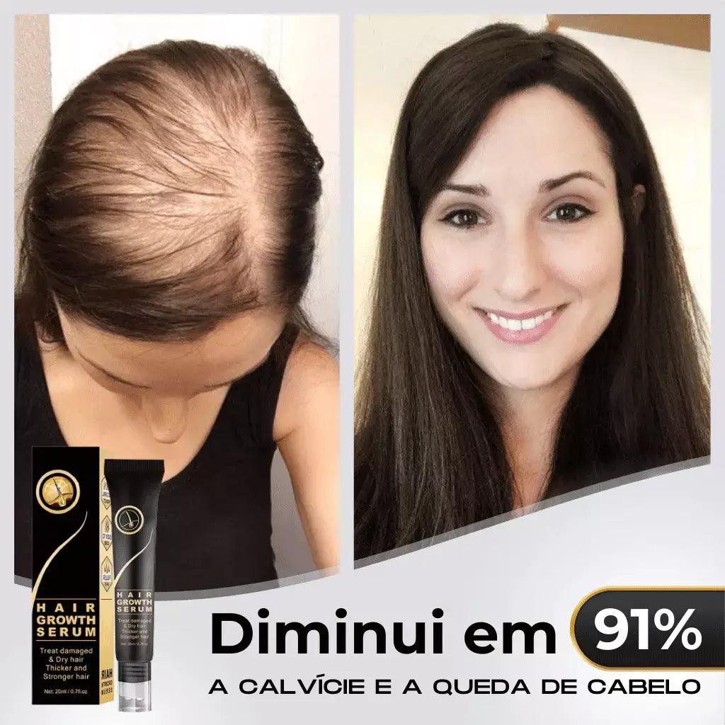 Tônico Capilar Repair Hair® | Crescimento Capilar e Combate à Queda de Cabelo - Bela Vital