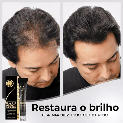 Tônico Capilar Repair Hair® | Crescimento Capilar e Combate à Queda de Cabelo - Bela Vital